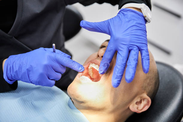 Best Chipped Tooth Repair Near Me  in Rusk, TX